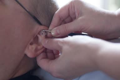 acupressure ear seeds