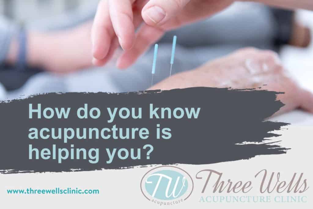 Acupuncture for the wrist